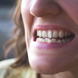 Nose-to-chin view of woman showing off her crooked teeth