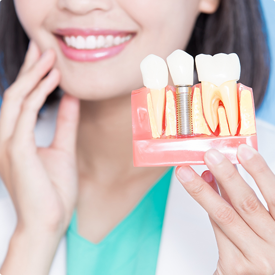 Female dentist holding model of dental implant in Phoenix