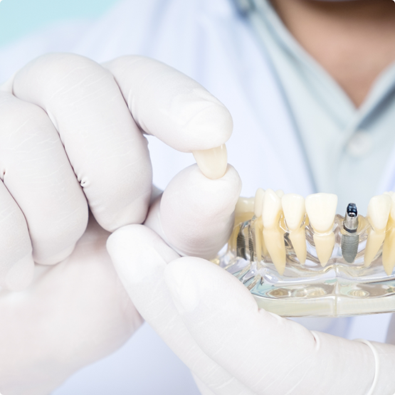 Dentist holding crown and plastic model with fake teeth and dental implants