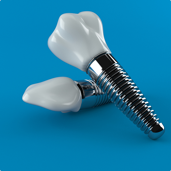 Two dental implants lying on blue surface