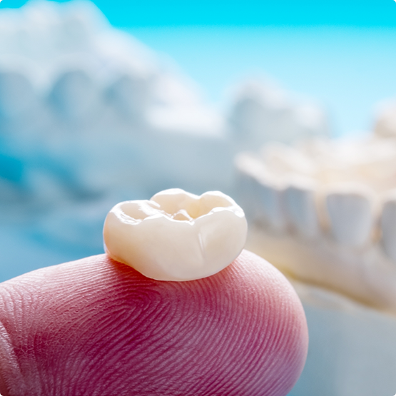 Close up of dental crown sitting on finger